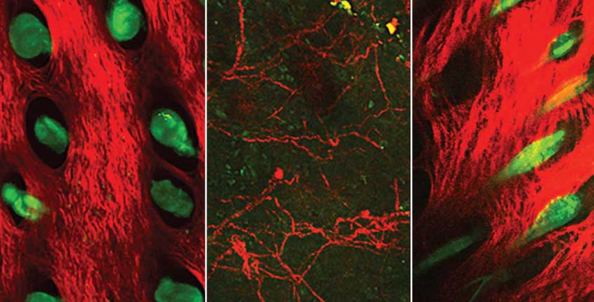 At left: Microscopy image of normal mouse skin showing collagen deposits (red) and hair follicles (green). The other two images show healed mouse skin 14 days after being burned. Center: Untreated wound contains disorganized collagen and few hair follicles. Right: Wound treated to deplete fidgetin-like 2 levels resembles normal mouse skin. 