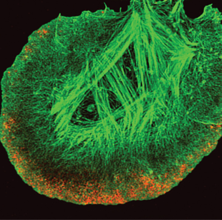 Einstein Image: Watching Actin Polymerize | Einstein Magazine